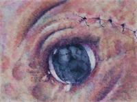 Sutures II