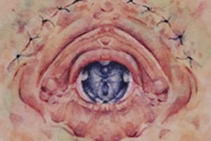 Lie Catcher I