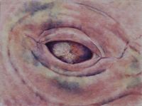 Diseased